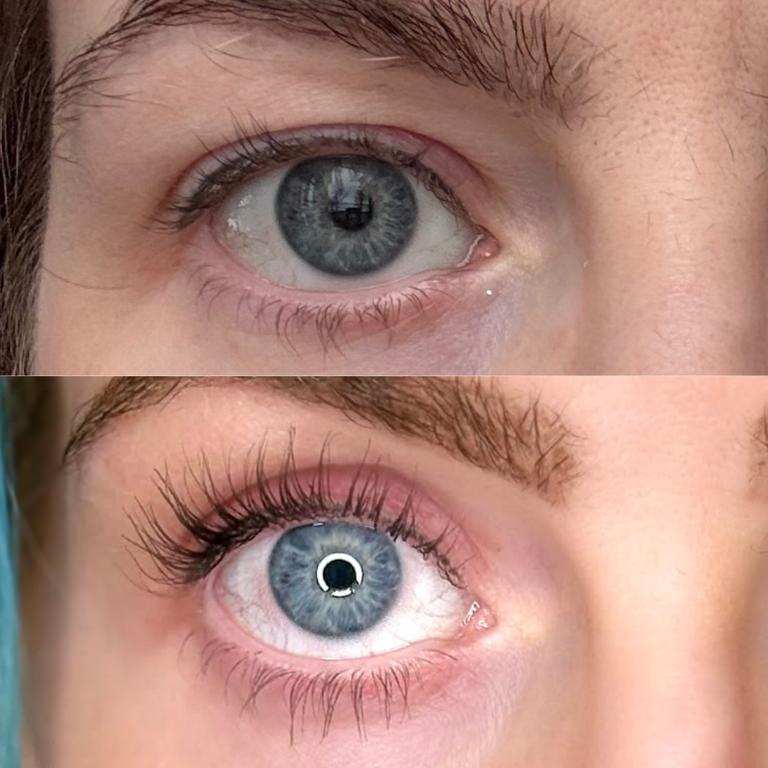 Lash Serum | INTENSE
