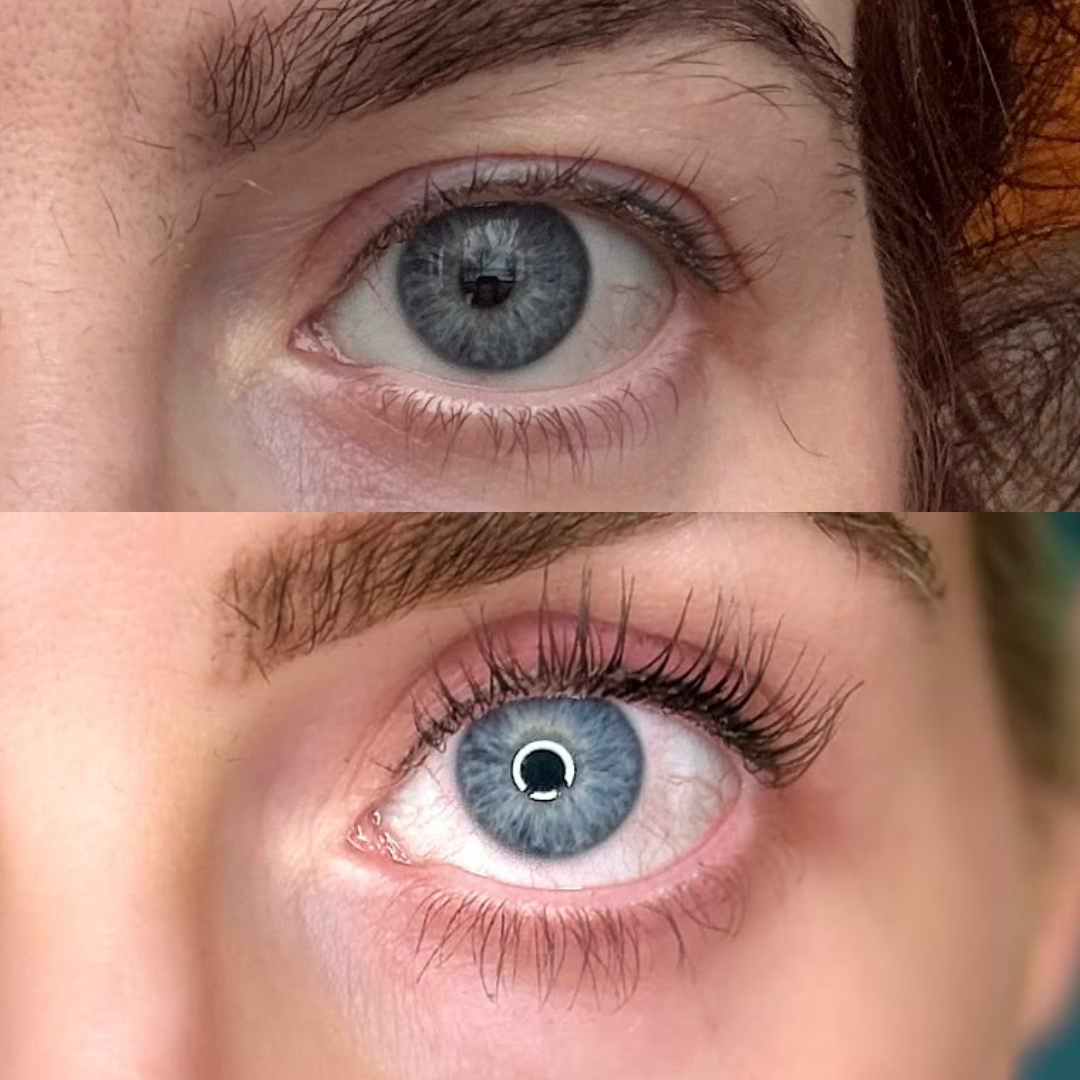 Lash Serum | INTENSE