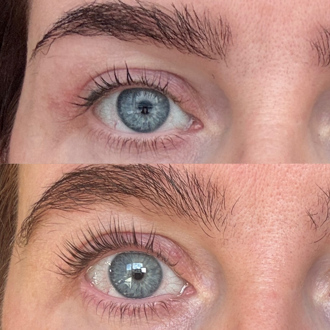 Lash serum | Sensitive