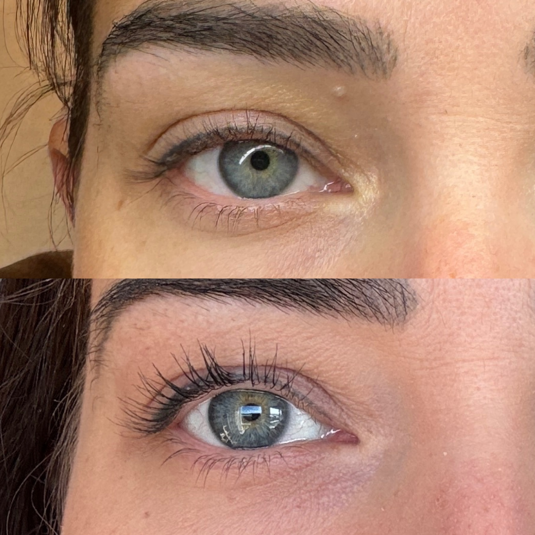 Lash serum | Sensitive