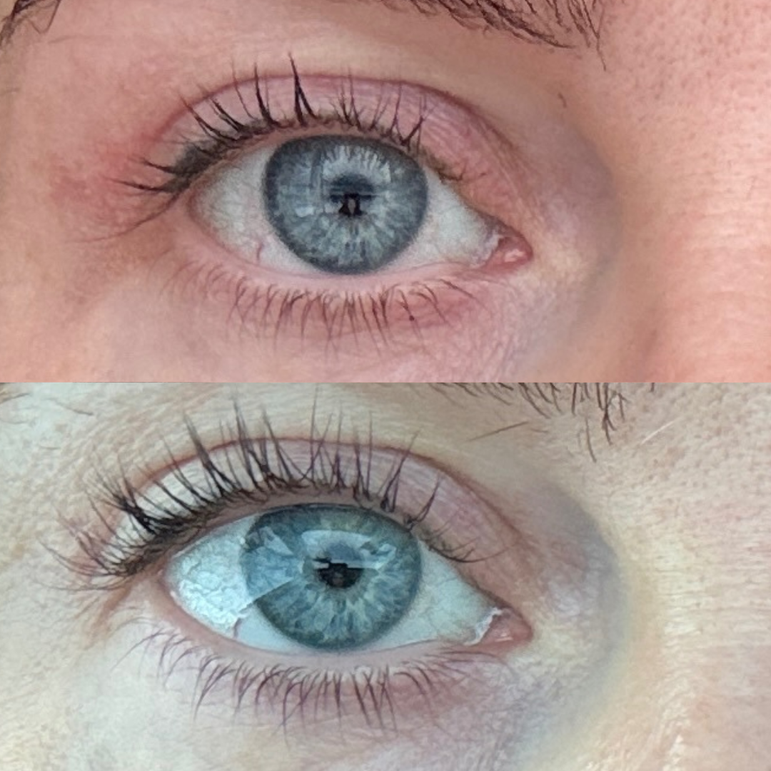 Lash serum