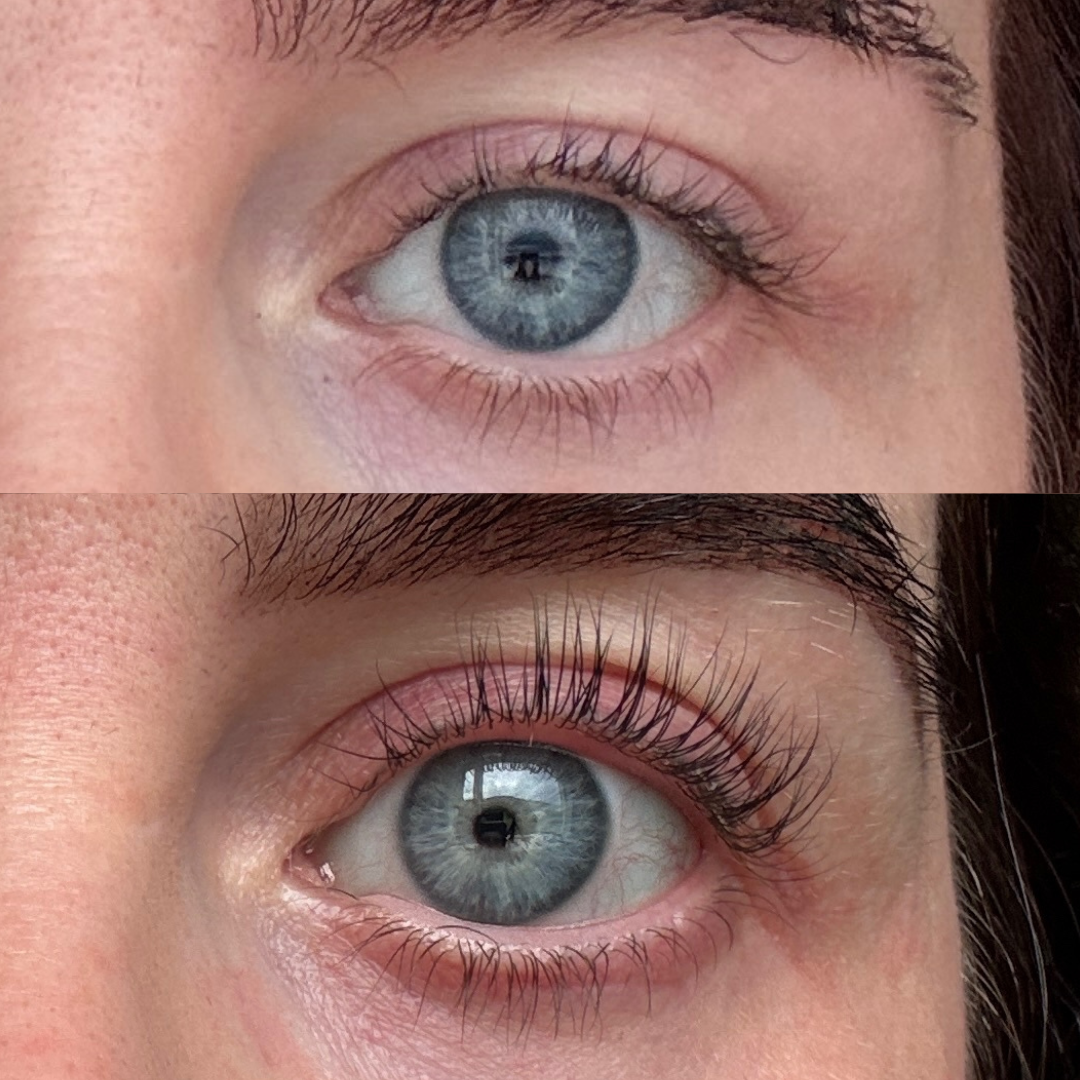 Lash Serum | INTENSE